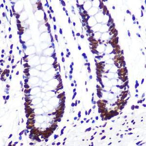 Immunohistochemistry analysis of paraffin-embedded human colon tissue using Anti-SAM68 Antibody [ARC0858] (A307676) at a dilution of 1:100 (40x lens) Perform microwave antigen retrieval with 10 mM PBS buffer pH 72 before commencing with IHC staining protocol