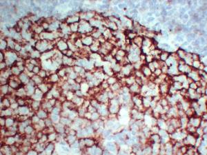 Immunohistochemical analysis of paraffin-embedded human Tonsil-high magnification using Anti-CD23 Antibody