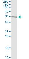 Anti-DBT Rabbit Polyclonal Antibody