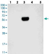 Anti-SLC38A6 Rabbit Polyclonal Antibody