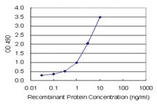 Anti-TP53I3 Polyclonal Antibody Pair