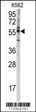 Anti-CYP4F8 Rabbit Polyclonal Antibody