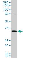 Anti-GGPS1 Mouse Polyclonal Antibody