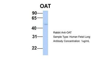 Anti-OAT Rabbit Polyclonal Antibody