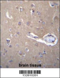 Anti-SEC62 Rabbit Polyclonal Antibody (Biotin)