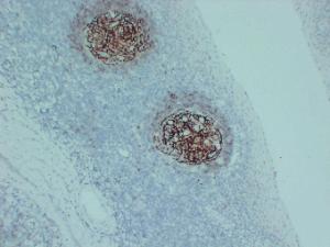 Immunohistochemical analysis of paraffin-embedded human Tonsil using Anti-CD23 Antibody