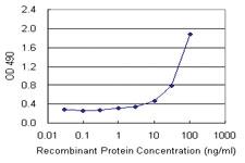 Anti-TP53RK Mouse Monoclonal Antibody (Biotin)