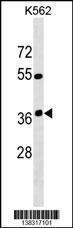 Anti-OR12D3 Rabbit Polyclonal Antibody (HRP (Horseradish Peroxidase))