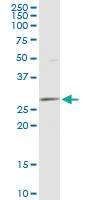 Anti-ECI1 Mouse Polyclonal Antibody