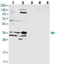 Anti-SCD Rabbit Polyclonal Antibody