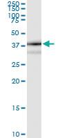 Anti-TP53I3 Polyclonal Antibody Pair