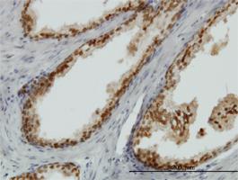 Anti-FOXA1 Mouse Monoclonal Antibody [clone: 3C1]