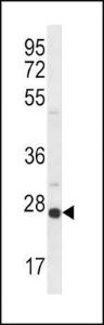 Anti-SIGMAR1 Rabbit Polyclonal Antibody