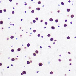 Immunohistochemistry analysis of paraffin-embedded mouse brain using Anti-SAM68 Antibody [ARC0858] (A307676) at a dilution of 1:100 (40x lens) Perform microwave antigen retrieval with 10 mM PBS buffer pH 72 before commencing with IHC staining protocol