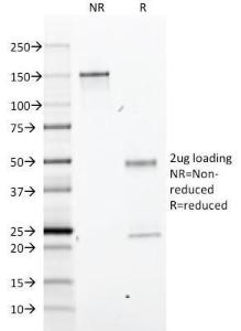 SDS-PAGE analysis of Anti-GFAP Antibody [GA-5] under non-reduced and reduced conditions; showing intact IgG and intact heavy and light chains, respectively. SDS-PAGE analysis confirms the integrity and purity of the antibody