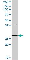 Anti-ECI1 Mouse Polyclonal Antibody