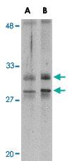 Anti-METTL7A Rabbit Polyclonal Antibody