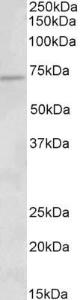 Anti-ACADVL Goat Polyclonal Antibody