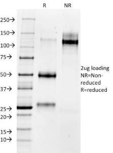 SDS-PAGE analysis of Anti-MMP3 Antibody [1B4] under non-reduced and reduced conditions; showing intact IgG and intact heavy and light chains, respectively. SDS-PAGE analysis confirms the integrity and purity of the antibody.