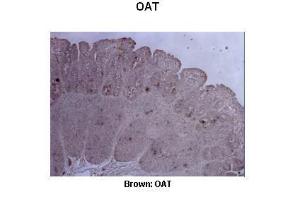 Anti-OAT Rabbit Polyclonal Antibody