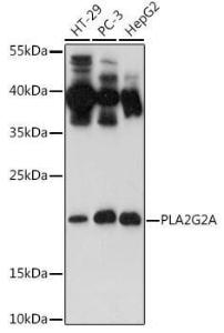 Western blot analysis of extracts of various cell lines, using Anti-Secretory phospholipase A2 Antibody (A11428) at 1:500 dilution. The secondary antibody was Goat Anti-Rabbit IgG H&L Antibody (HRP) at 1:10,000 dilution.