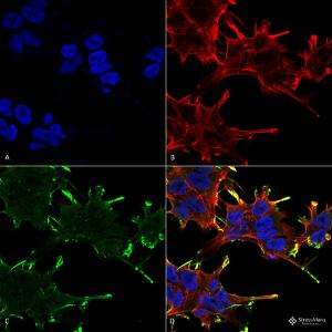 Anti-alpha B Crystallin antibody