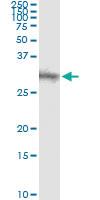 Anti-DKK1 Antibody Pair