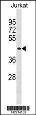 Anti-MBNL1 Rabbit Polyclonal Antibody (Biotin)