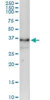 Anti-ZMAT3 Polyclonal Antibody Pair