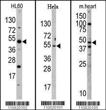 Anti-JMJD6 Rabbit Polyclonal Antibody (HRP (Horseradish Peroxidase))