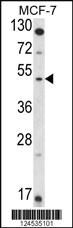 Anti-HSD11B2 Rabbit Polyclonal Antibody