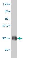 Anti-EML4 Mouse Monoclonal Antibody [clone: 3C10]