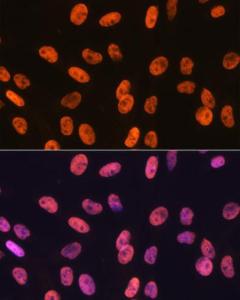 Immunofluorescence analysis of C6 cells using Anti-SAM68 Antibody [ARC0858] (A307676) at a dilution of 1:100 (40x lens) DAPI was used to stain the cell nuclei (blue)