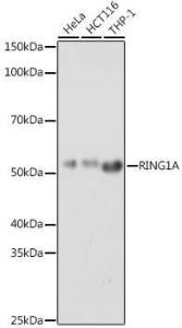 Western blot analysis of extracts of various cell lines, using Anti-RING1 Antibody (A305946) at 1:1,000 dilution. The secondary antibody was Goat Anti-Rabbit IgG H&L Antibody (HRP) at 1:10,000 dilution.