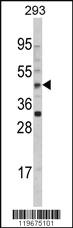 Anti-AADAC Rabbit Polyclonal Antibody