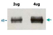 Anti-DNMT3L Rabbit Polyclonal Antibody