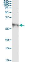 Anti-DKK1 Antibody Pair