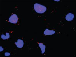 Anti-PTK2 + ERBB2 Antibody Pair