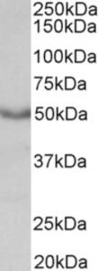 EB07398 (0.3 µg/ml) staining of Mouse Heart lysate (35 µg protein in RIPA buffer). Primary incubation was 1 hour. Detected by chemiluminescence.