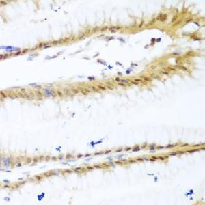 Immunohistochemistry analysis of paraffin-embedded human stomach using Anti-UNG Antibody (A11430) at a dilution of 1:100 (40x lens)