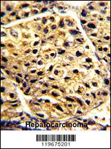 Anti-AADAC Rabbit Polyclonal Antibody