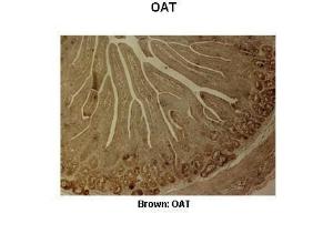 Anti-OAT Rabbit Polyclonal Antibody