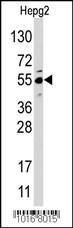 Anti-JMJD4 Rabbit Polyclonal Antibody (AP (Alkaline Phosphatase))