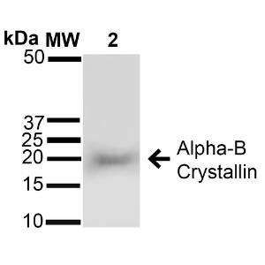 Western blot analysis of rat brain cel