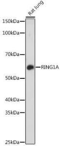 Western blot analysis of extracts of Rat lung, using Anti-RING1 Antibody (A305946) at 1:1,000 dilution. The secondary antibody was Goat Anti-Rabbit IgG H&L Antibody (HRP) at 1:10,000 dilution.