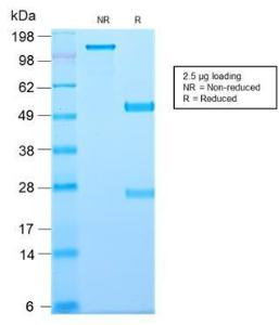 SDS-PAGE analysis of Anti-TAPA1 Antibody [C81/2885R] under non-reduced and reduced conditions; showing intact IgG and intact heavy and light chains, respectively. SDS-PAGE analysis confirms the integrity and purity of the antibody.