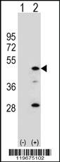 Anti-AADAC Rabbit Polyclonal Antibody