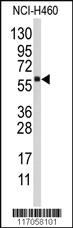 Anti-CYP4F12 Rabbit Polyclonal Antibody