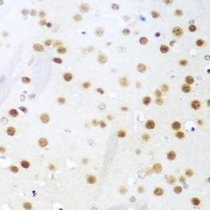 Immunohistochemistry analysis of paraffin-embedded mouse brain using Anti-UNG Antibody (A11430) at a dilution of 1:100 (40x lens)