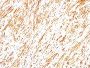 Antibody anti-GFAP SPM248 100 µg